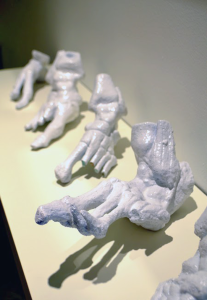 http://3dprintingindustry.com/wp-content/uploads/2014/07/3D-printed-feet-for-surgery-preparation-207x300.png