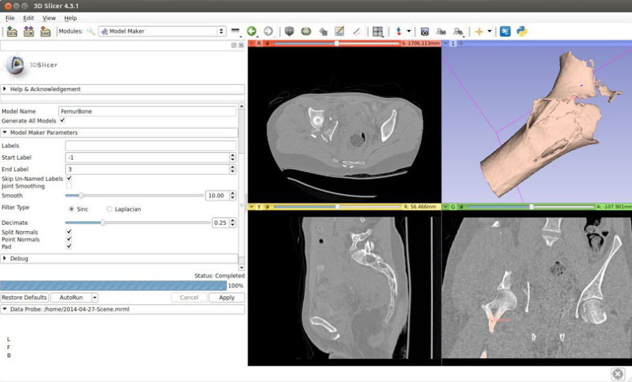 How To 3d Print Your Own Ct Scans 3d Printing Industry