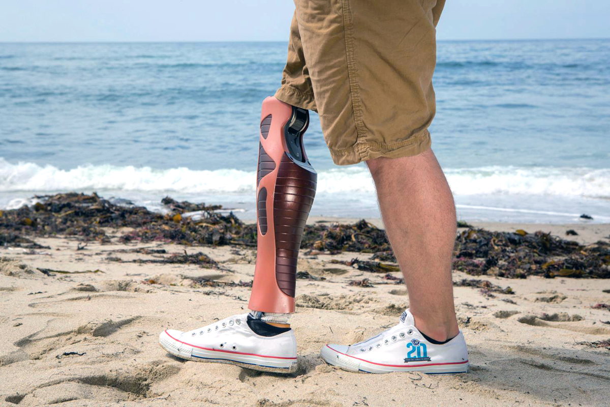 http://3dprintingindustry.com/wp-content/uploads/2015/02/3D-printed-prosthetic-leg-covers-from-unyq.jpg