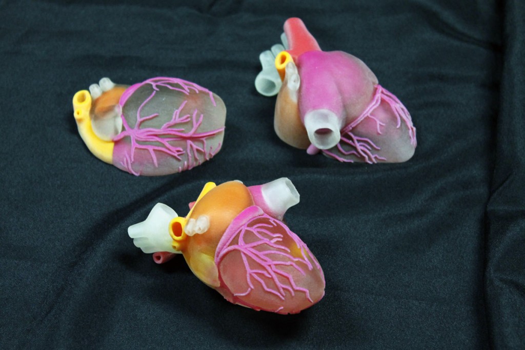 3D Ops 3D printed surgical heart models