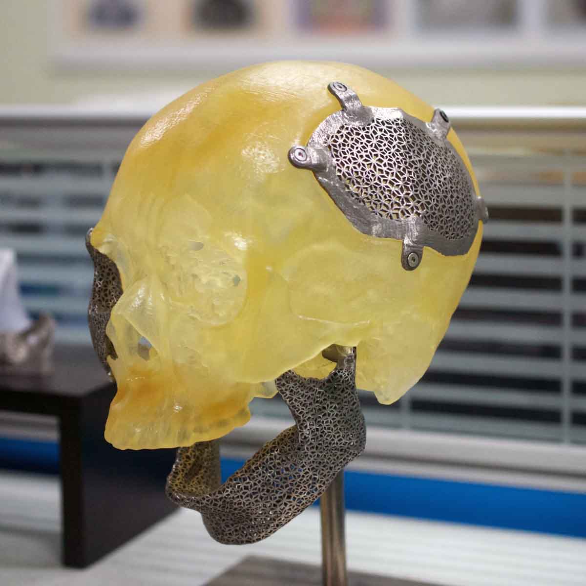 ITRI optical engine metal 3D printer 3D printed medical implant
