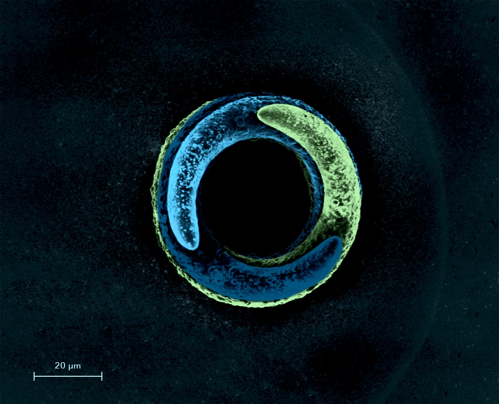 microscope cytosurger fluidfm micro metal 3D printing