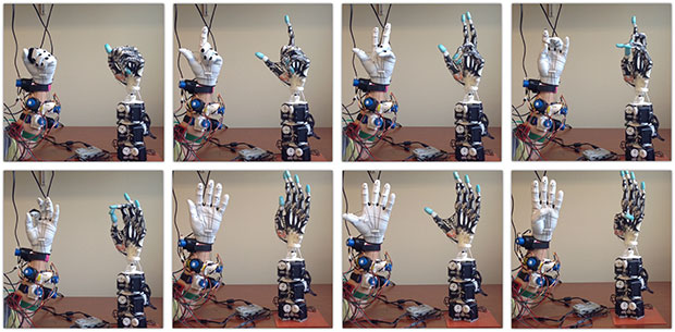 University of Washington 3D printed biomimetic prosthetic-hand moving