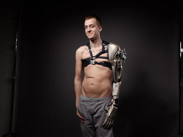 amputee-james-young-gets-cool-3d-printed-bionic-prosthetic-inspired-by-metal-gear-solid-game-1