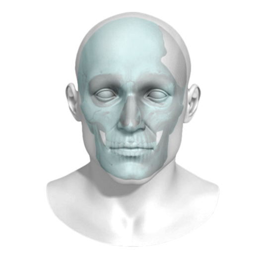 bio architects 3D printed titanium cranio and craniofacial implant face
