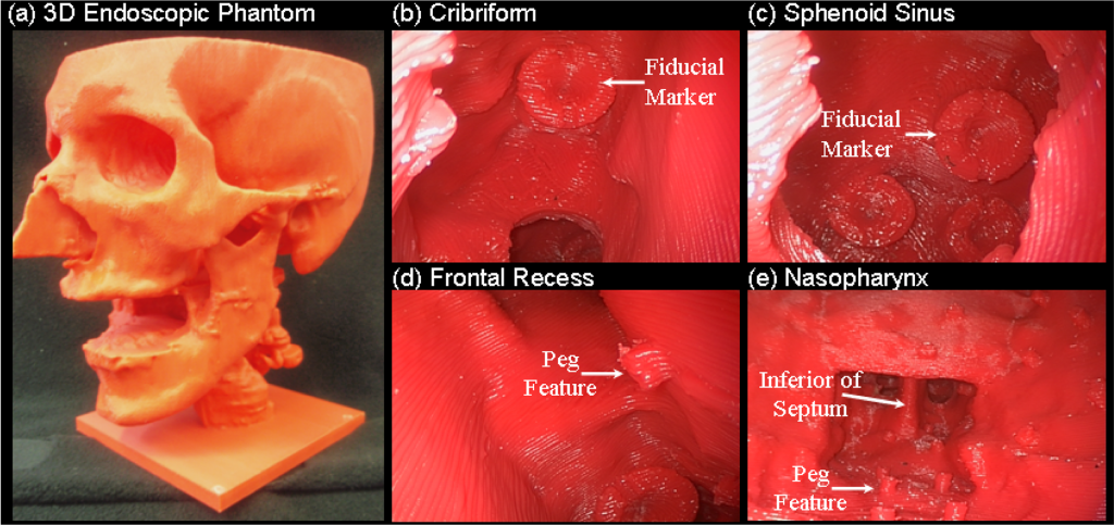Photographs of 3D endoscopic phantom for the turn it intoment of real-time tracking/navigation and image fusion methods