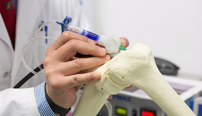 Biopen 3D Printing Medical
