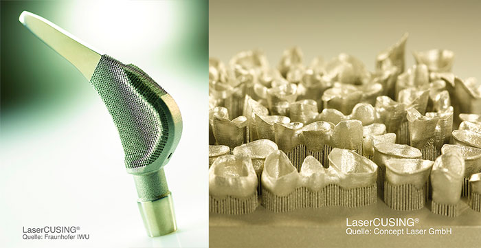 Dental 3D Printing Concept Laser
