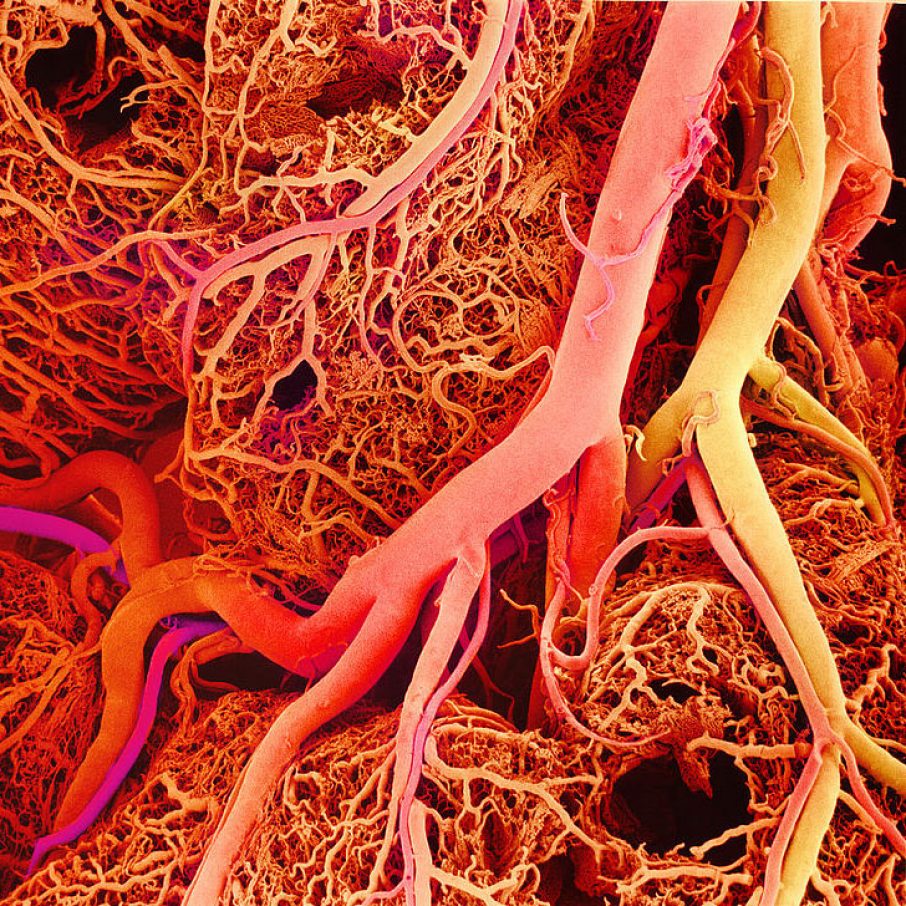 Bwh Progress Bioprinting Blood Vessels 3d Printing Industry