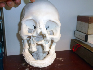 face transplants 3D printed skull
