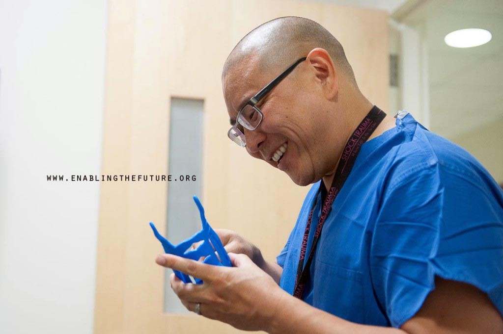 Dr. Albert holds 3D printed prosthetic from e-nable in haiti