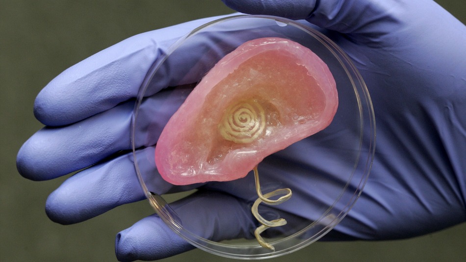 3D printed Bionic Ear from Princeton