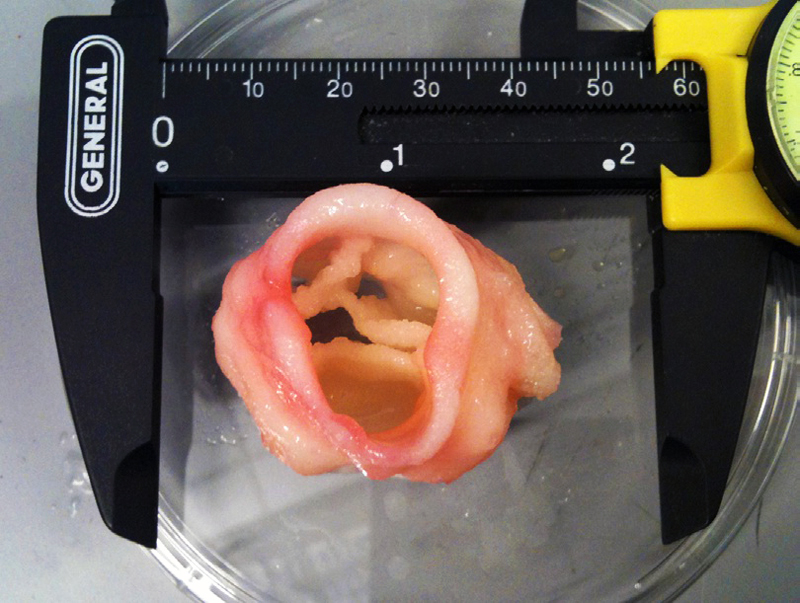 3D printed artificial-heart-valve from jonathan butcher