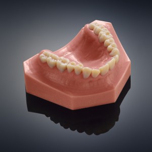 3D printed dental models from objet