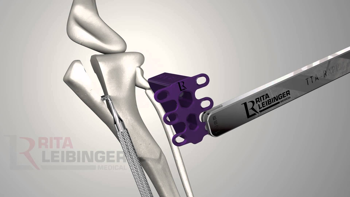 3D printed dog ligament implant