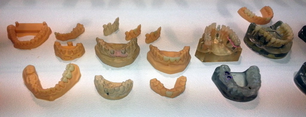 3D printed dental devices at SIDEX 2015 in Koreaa