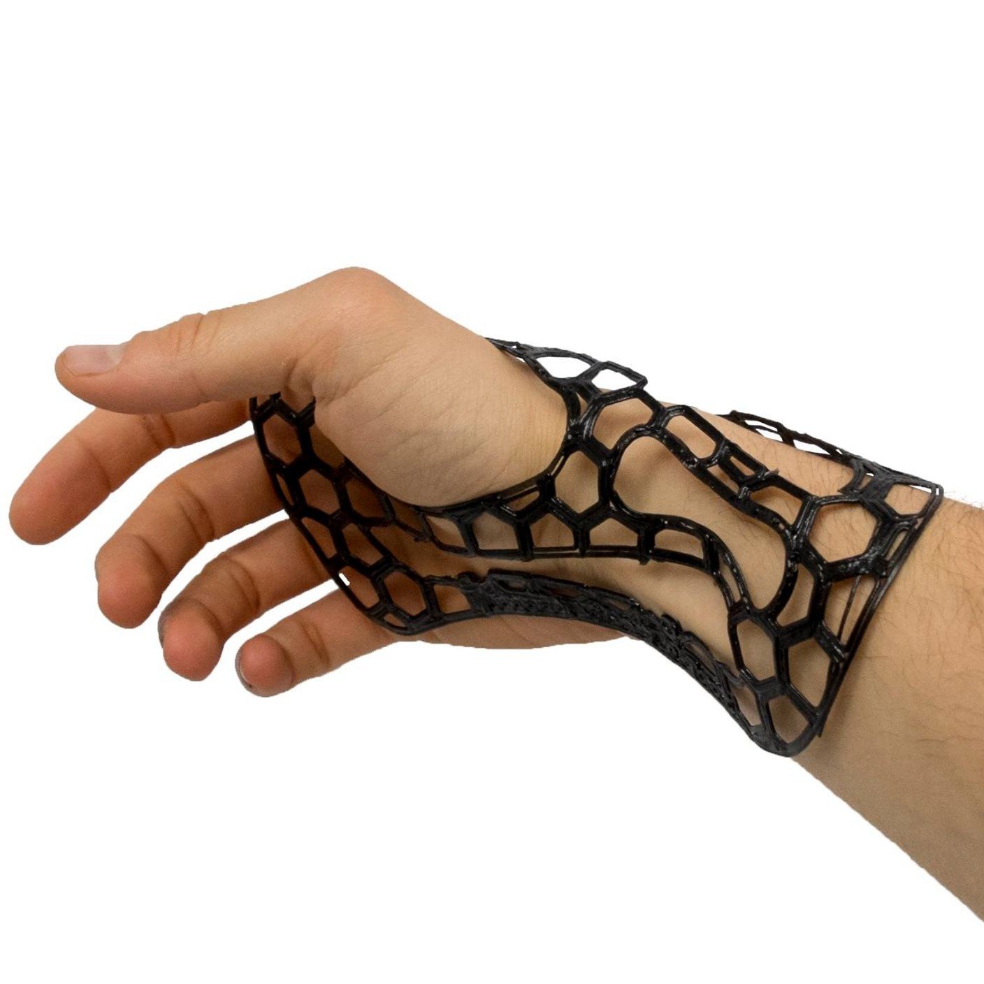 Prof. Levi’s +Lab 3D Prints Arm Braces Using High Performance