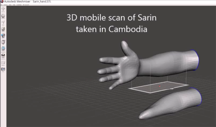 3D scan to create 3D printed flexible prosthetic