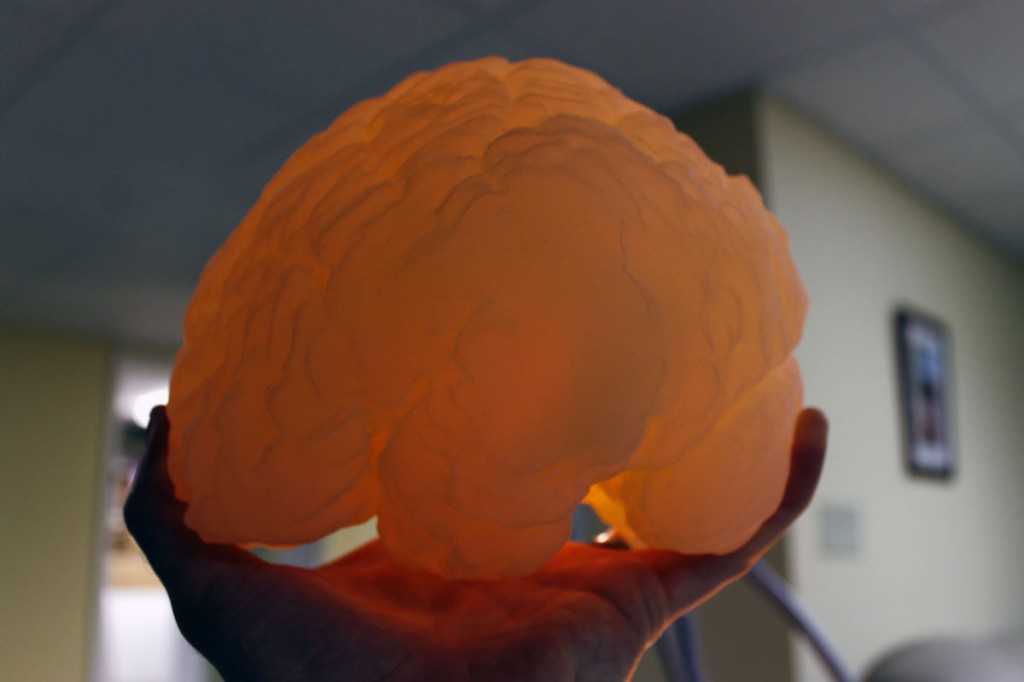 3D Ops 3D printed surgical brain models