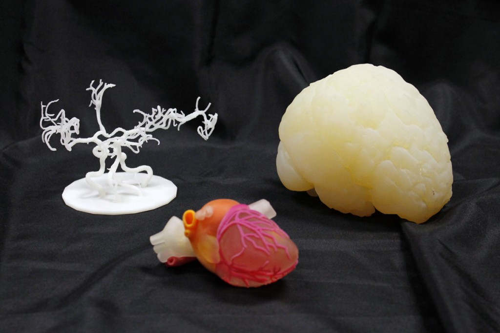 3D Ops 3D printed surgical models