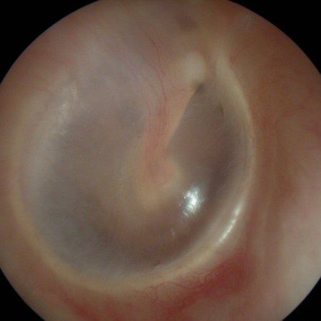 You Hear They're Bioprinting an Ear Drum? - 3D Printing Industry