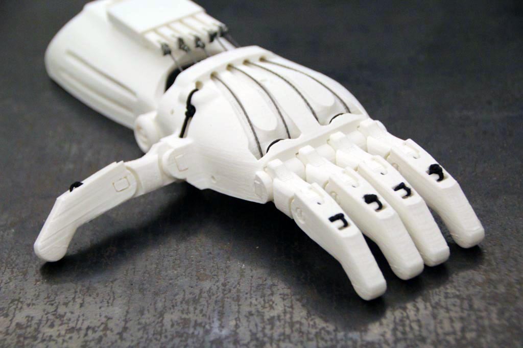 Awaken Round down Up 3d printed prosthetic hand - jauhigalau.com