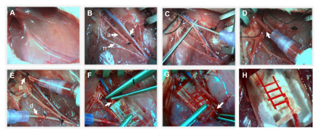 3D printed blood vessel network from Rice University Jordan Miller successfully implanted in rat