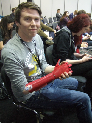 An amputee and his prosthesis produced by Open Bionics. © H. Dodziuk
