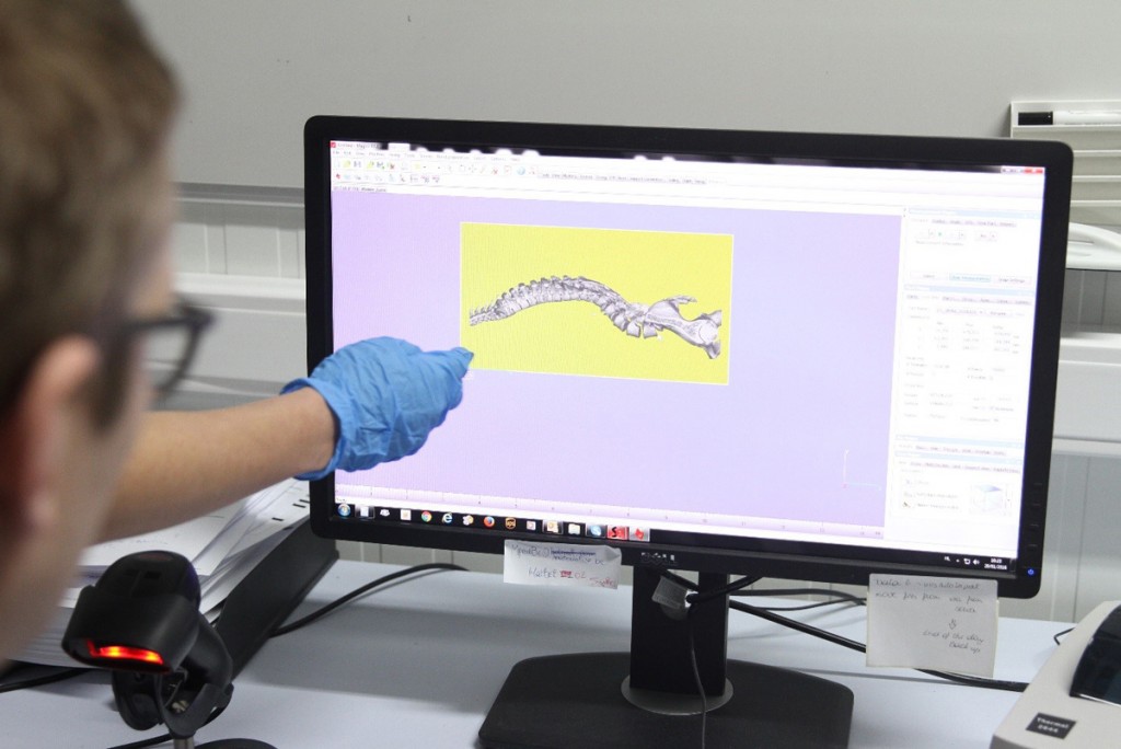 Vanessa Palsenbarg's 3D printable model of spine materialise