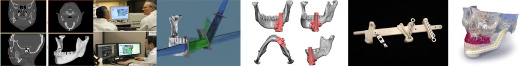 virtual surgical planning with 3D printing from 3D Systems
