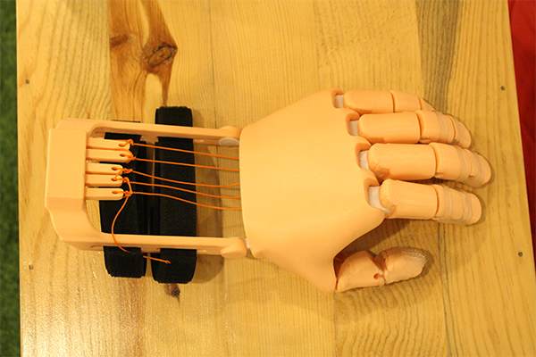 Prosthetic 3D printed hand