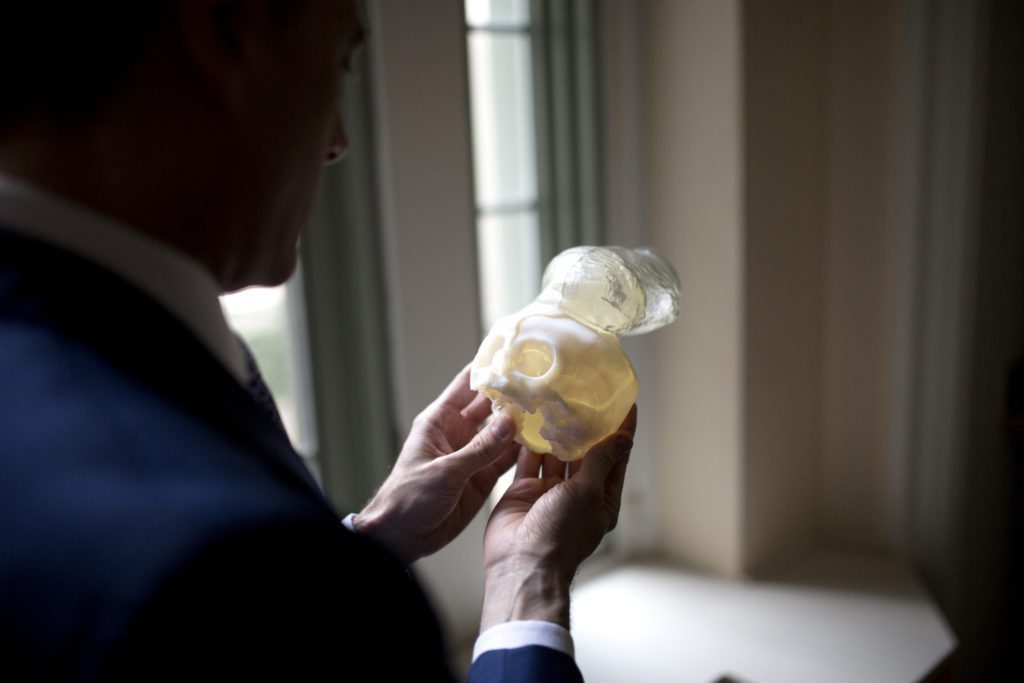 Dr. John Meara of Boston Children's hospital holds a 3D model of Bentley Yoder's skull and brain, showing the encephalocele, or the brain protrusion that grew out of the boy's skull as he developed in the womb. Dr. Meara was part of a team that used advanced imaging to produce an exact model of Bentley's deformity before operating on it, which allowed them to finish the surgery fast and without complication, at Boston Children's hospital, June 10, 2016. (Jeffery DelViscio/STAT)