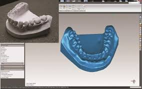 Smarttech dental 3D scans could save time and money