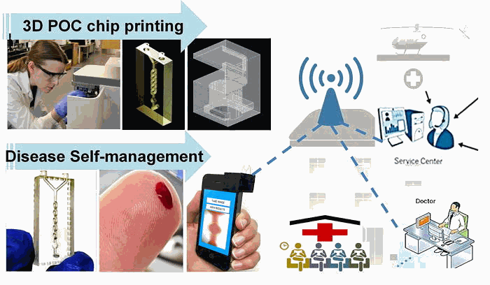 Low-cost, smartphone-based, 3D-printed POC microfluidic chip (smartphone iPOC3D system) for rapid diagnosis of anemia in 60 s.