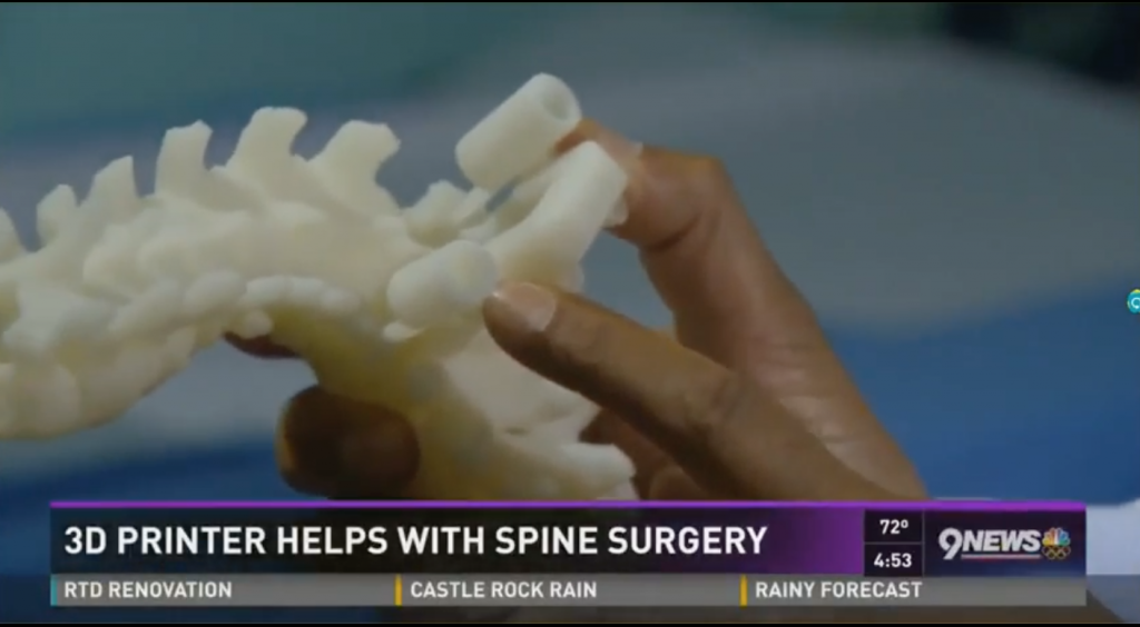 Firefly Technology guides have been used here to help a patient with scoliosis be more active. Screenshot of a 9News report via: Mighty Oak Medical on Youtube
