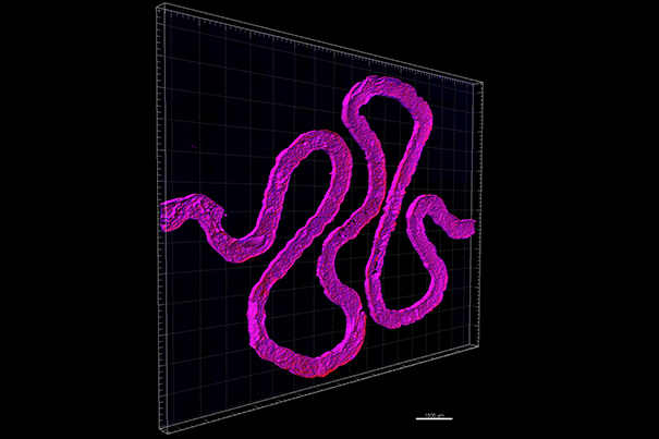 The structure of a 3D printed kidney vessel Image via: Wyss Institute at Harvard University