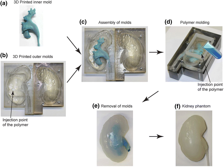 The process of making a 3D phantom kidney. Image via: Adams, F., Qiu, T., Mark, A. et al.