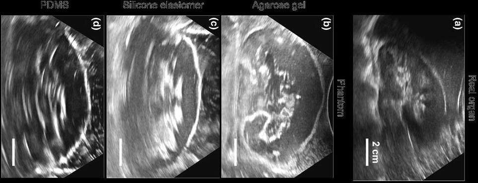 Comparison CT scans of different material kidneys Image via: Adams, F., Qiu, T., Mark, A. et al.