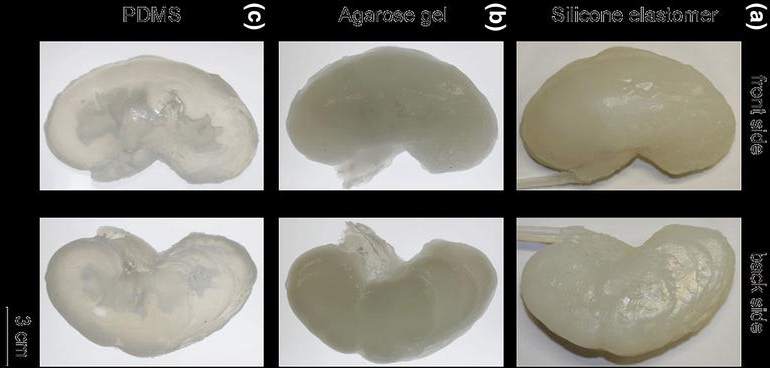 Phantom kidneys molded in PDMS, agarose and silicone