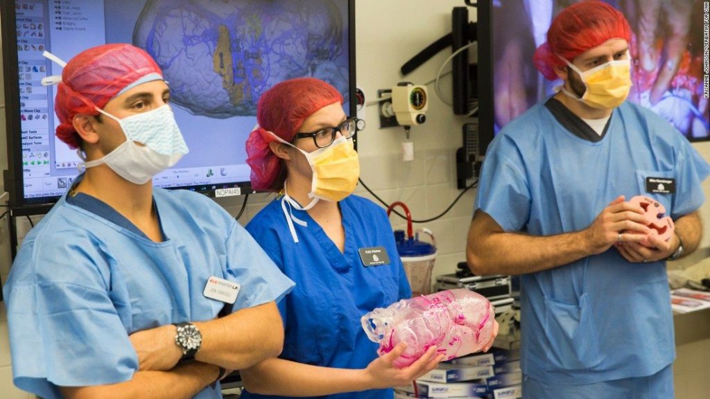 Katie Weimer and Mike Rensberger of 3D Systems hold a 3D printed surgical model used in the operation on conjoined MacDonald twins. Photo via CNN
