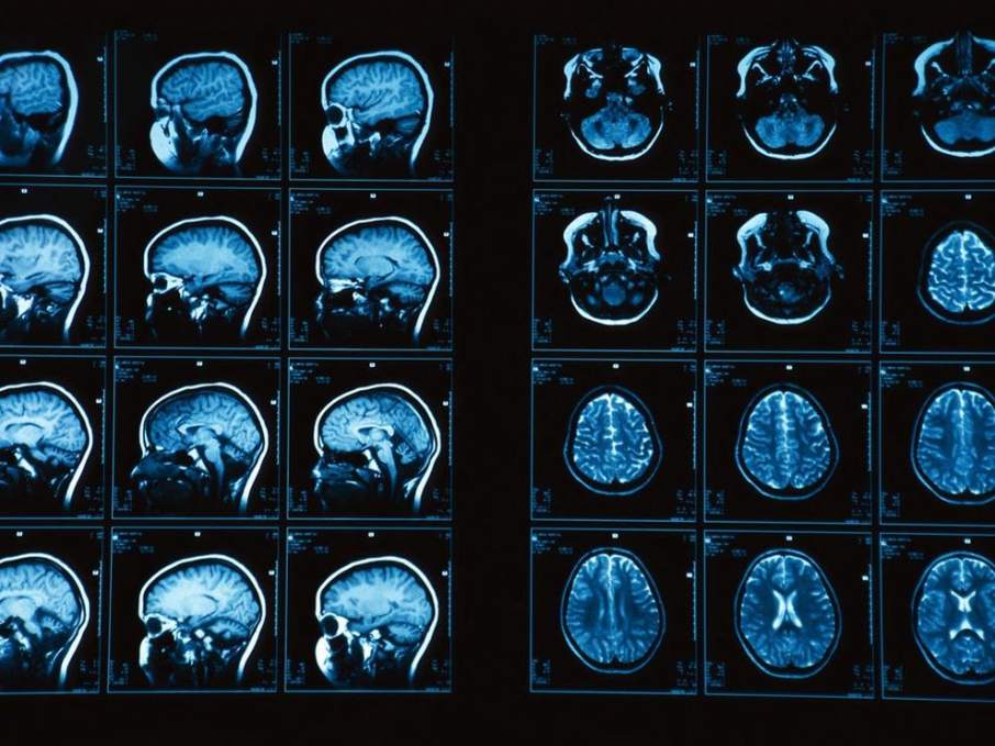 Brain MRI scan photograph by Ken Glasercorbis, via: National Geographic