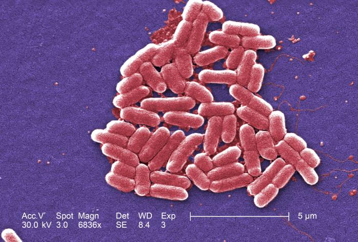 Colored SEM picture of e. coli. Image via: Janice Haney Carr