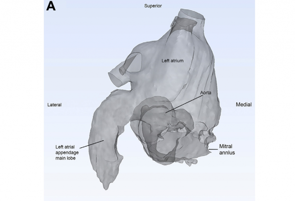 A 3D image of a heart via: Wang et al.