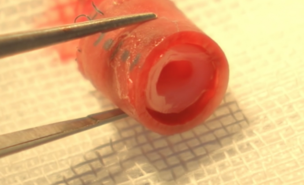 A fully cultured section of a blood vessel 3D printed by Revotek researchers. Screenshot via: CCTV+ on Youtube