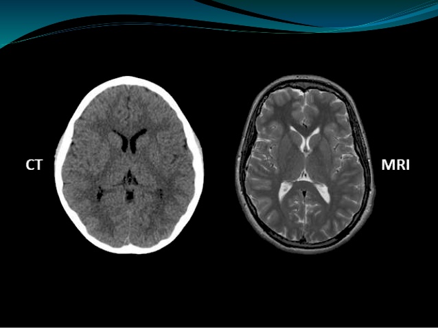 Ajay Nagisetti's presentation of CT Scan vs MRI Scan. Via: Slideshare