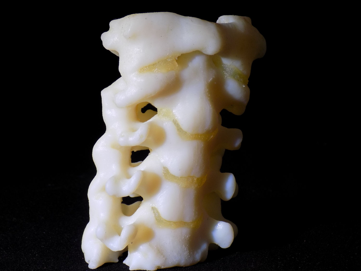 Cervical spine with cartilage. Photo via SiMMO3D. 