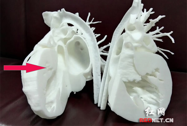 A 1:1 scale 3D printed heart replica. Image via Rednet.cn.