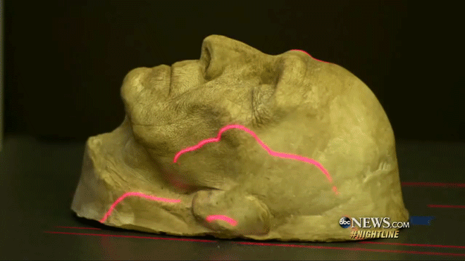 Gif showing the process of 3D scanning the model of Cushing's face. Image via ABC News. 