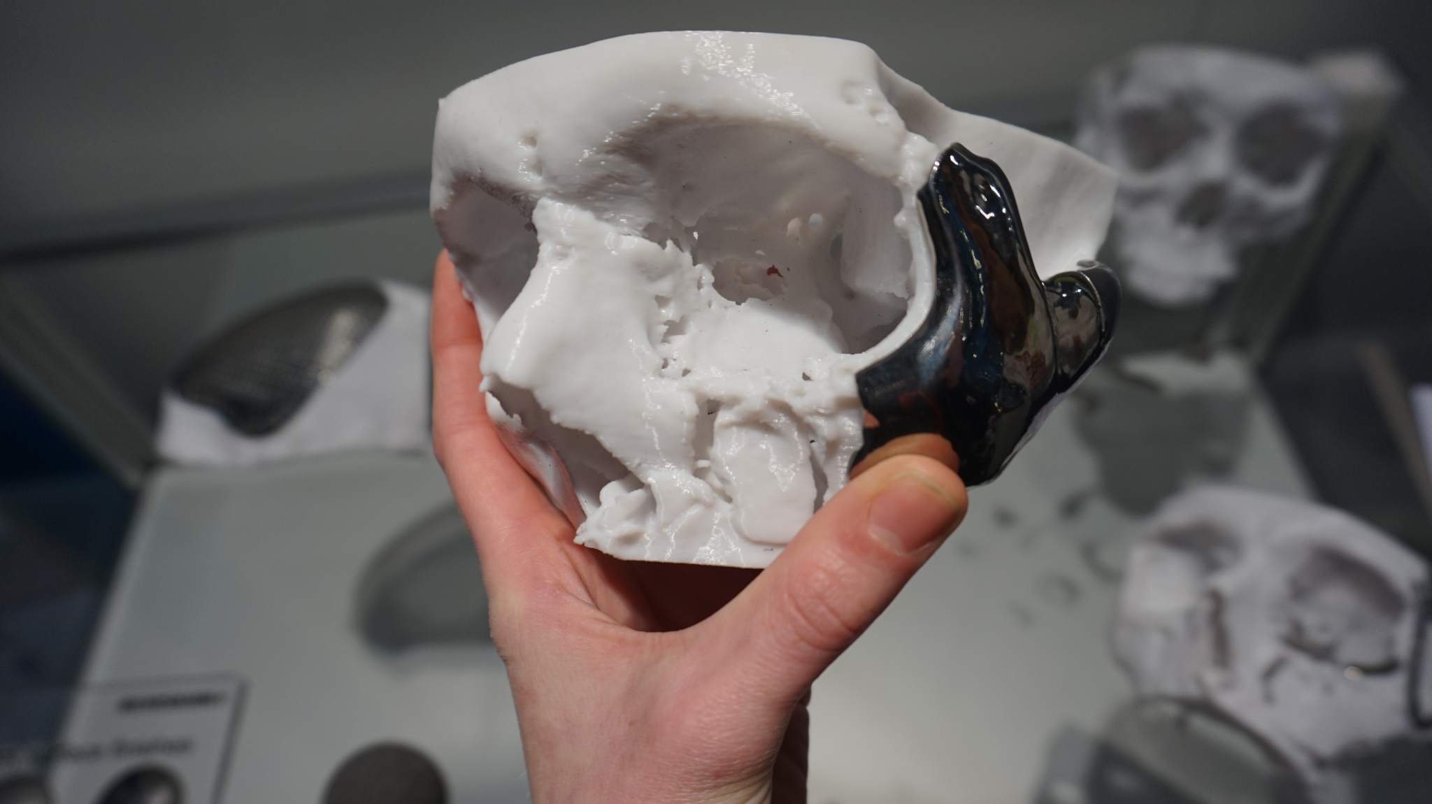 A closer look at 3D printing in dentistry from the 3D Medical Expo 2017 ...
