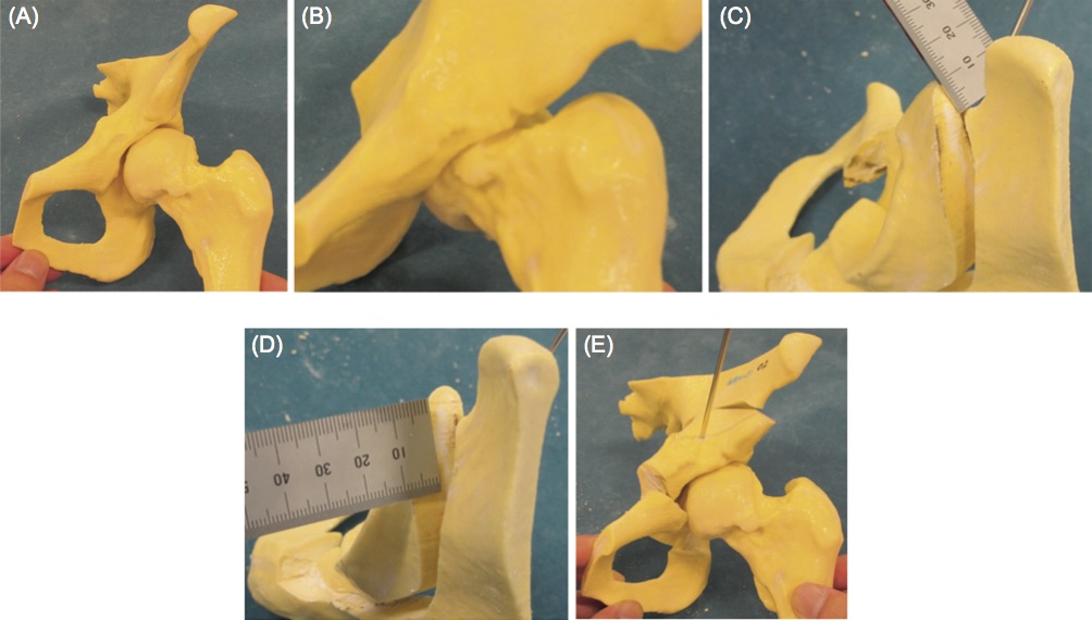 The 3D printed salt hip bone Figure via Kensuke Fukushima et al.